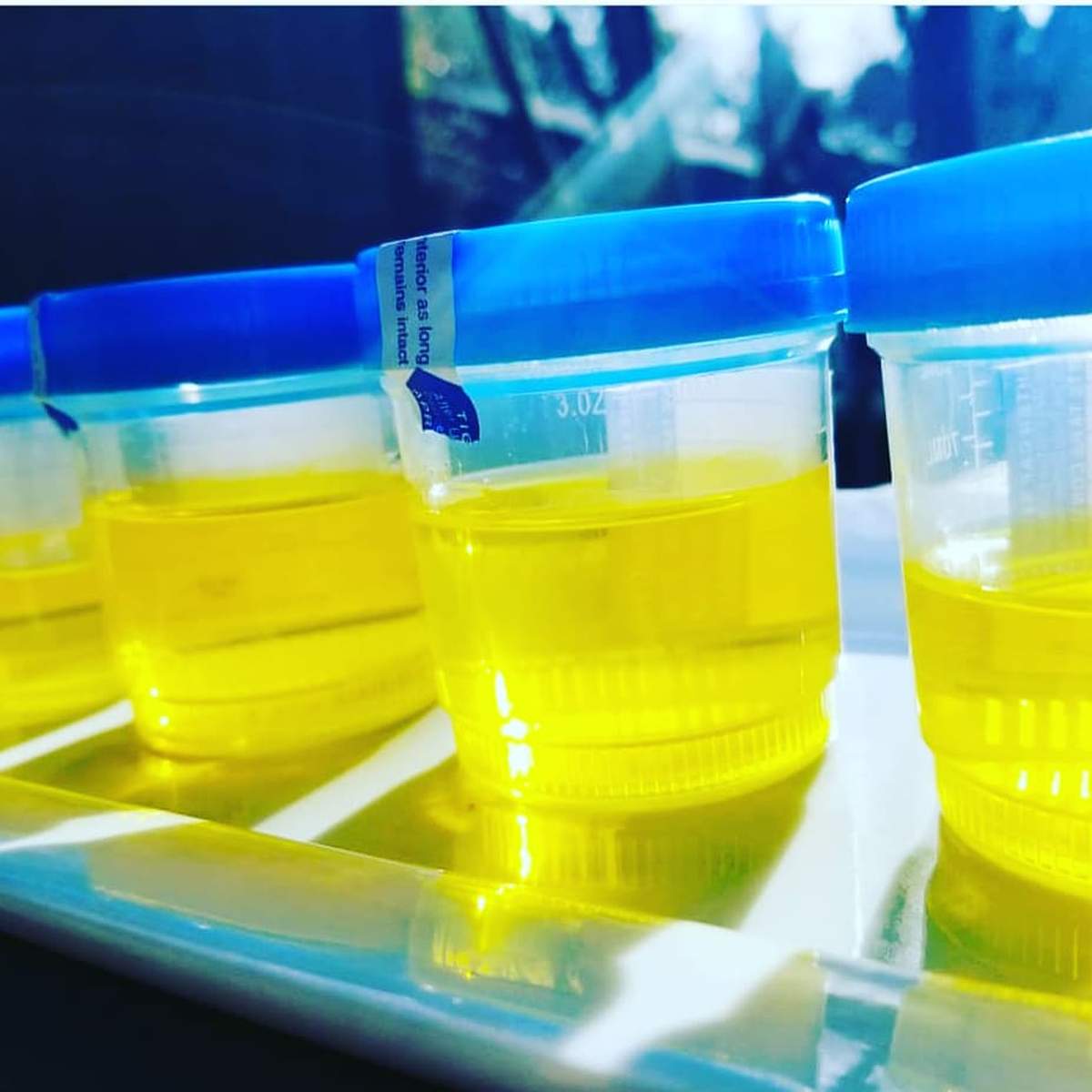 A Nurse's Graduation  - Nurse Party 